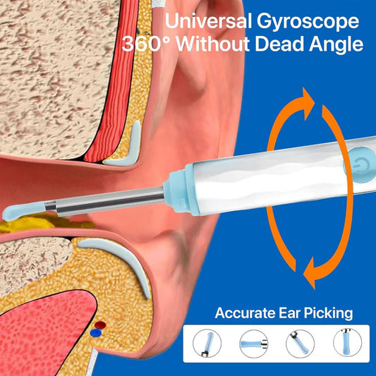 Smart Visual Ear Wax Cleaner Full HD