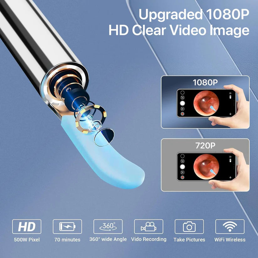 Smart Visual Ear Wax Cleaner Full HD